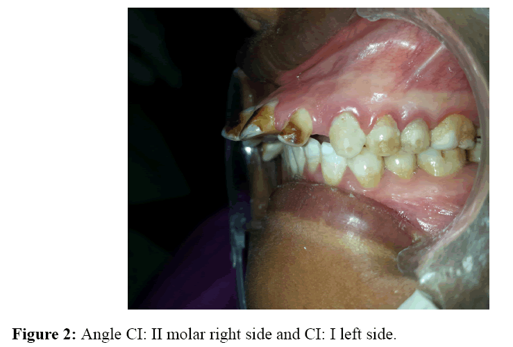 internalmedicine-Angle-CI-left-side