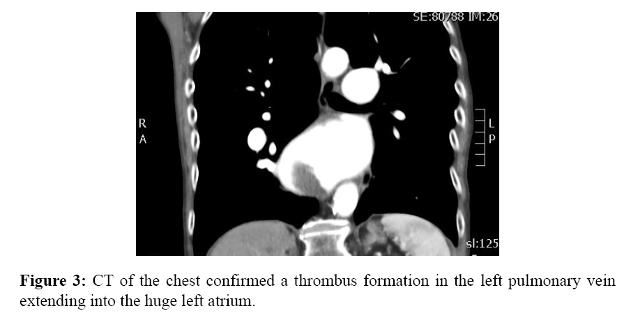 internalmedicine-CT-chest-confirmed