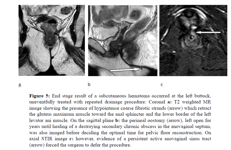 internalmedicine-End-stage-result