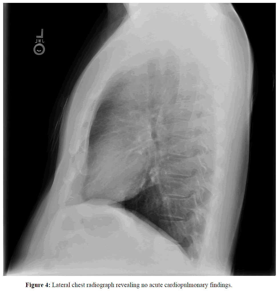 internalmedicine-Lateral-chest-radiograph