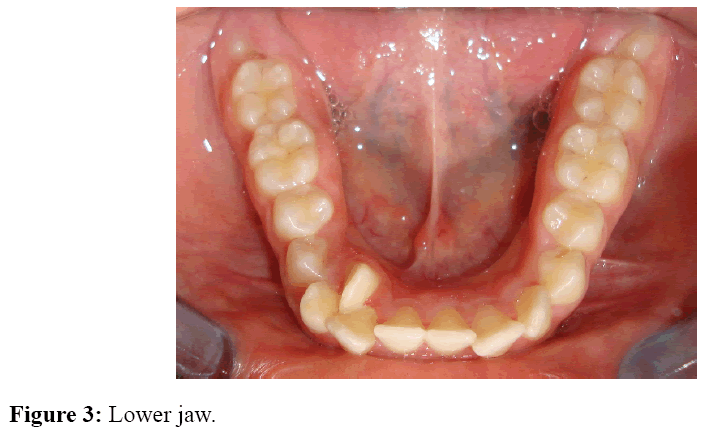internalmedicine-Lower-jaw