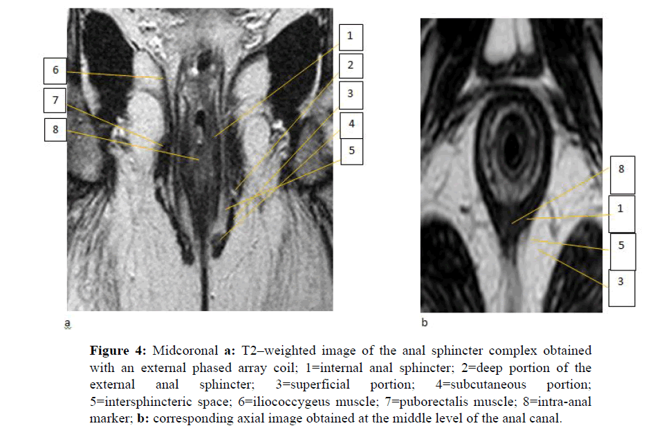 internalmedicine-Midcoronal