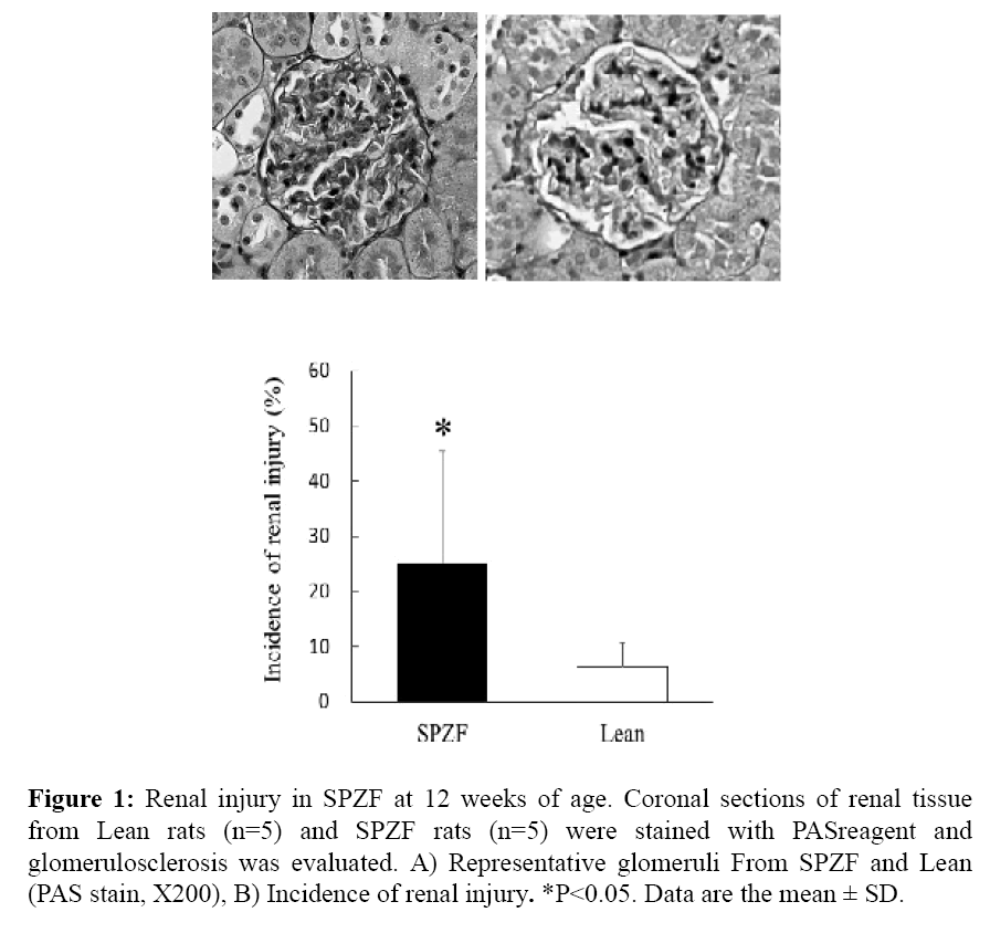 internalmedicine-Renal-injury