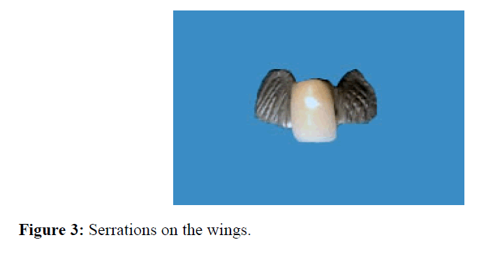 internalmedicine-Serrations-wings