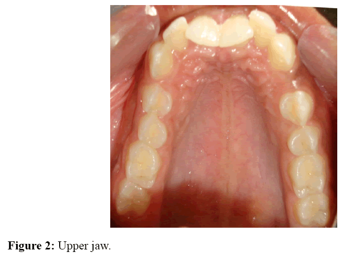 internalmedicine-Upper-jaw