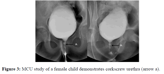 internalmedicine-female-child
